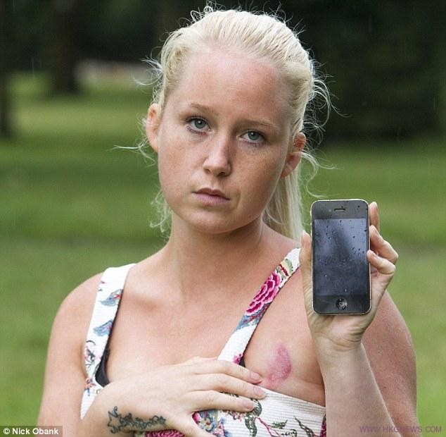 女子抱iPhone入睡被灼傷